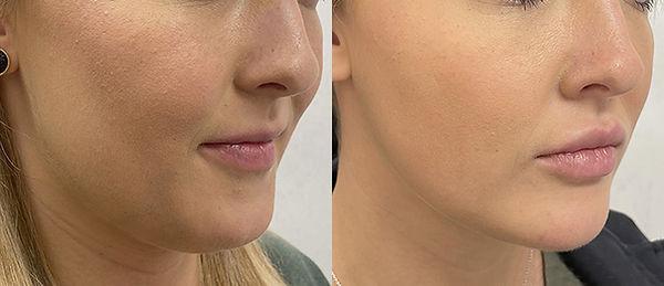 Vigam Medical Spa and Laser result — Hillsboro, OR