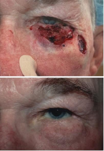 The Aesthetic Center at Virginia Eye Institute result — Henrico, VA