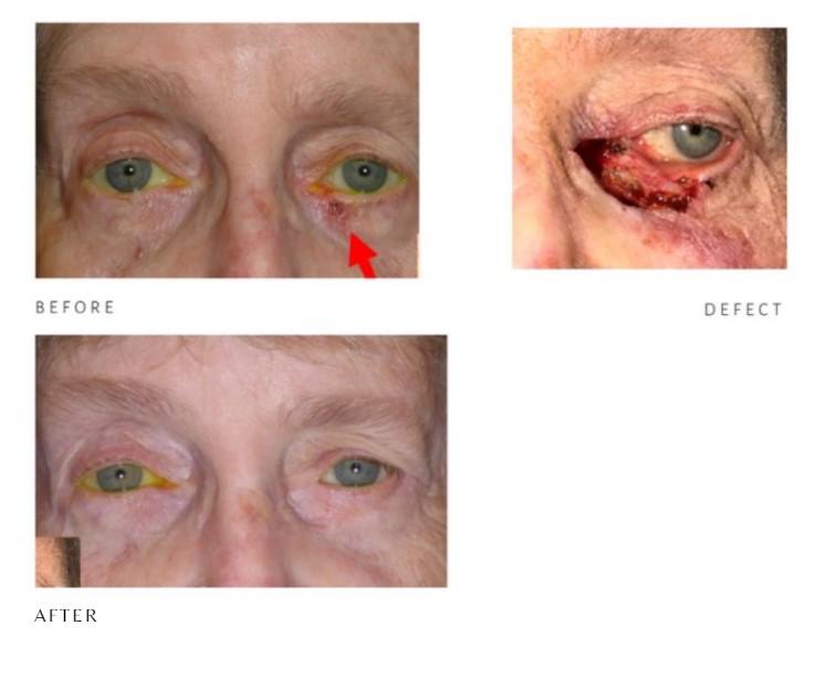 The Aesthetic Center at Virginia Eye Institute result — Henrico, VA