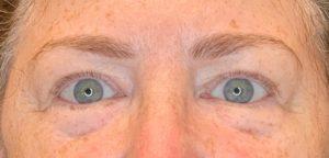 Dr. Darrin M. Hubert, MD result — Richmond, VA
