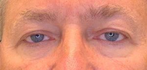 Dr. Darrin M. Hubert, MD result — Richmond, VA