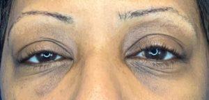 Dr. Darrin M. Hubert, MD result — Richmond, VA