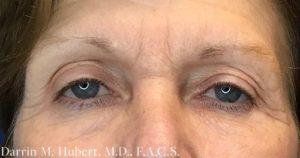 Dr. Darrin M. Hubert, MD result — Richmond, VA