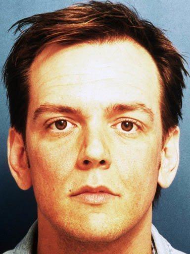 Shapiro Plastic Surgery rhinoplasty after — Scottsdale, AZ