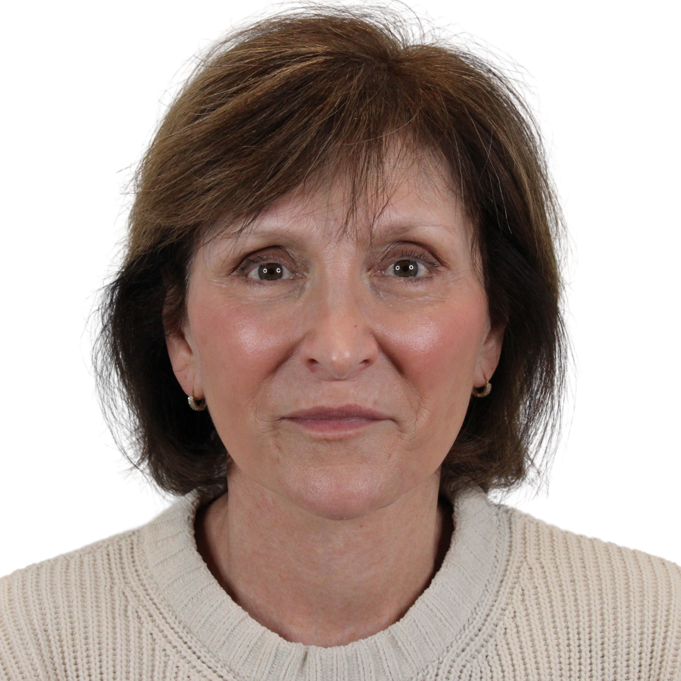 Admire Plastic Surgery facelift after — Gilbert, AZ