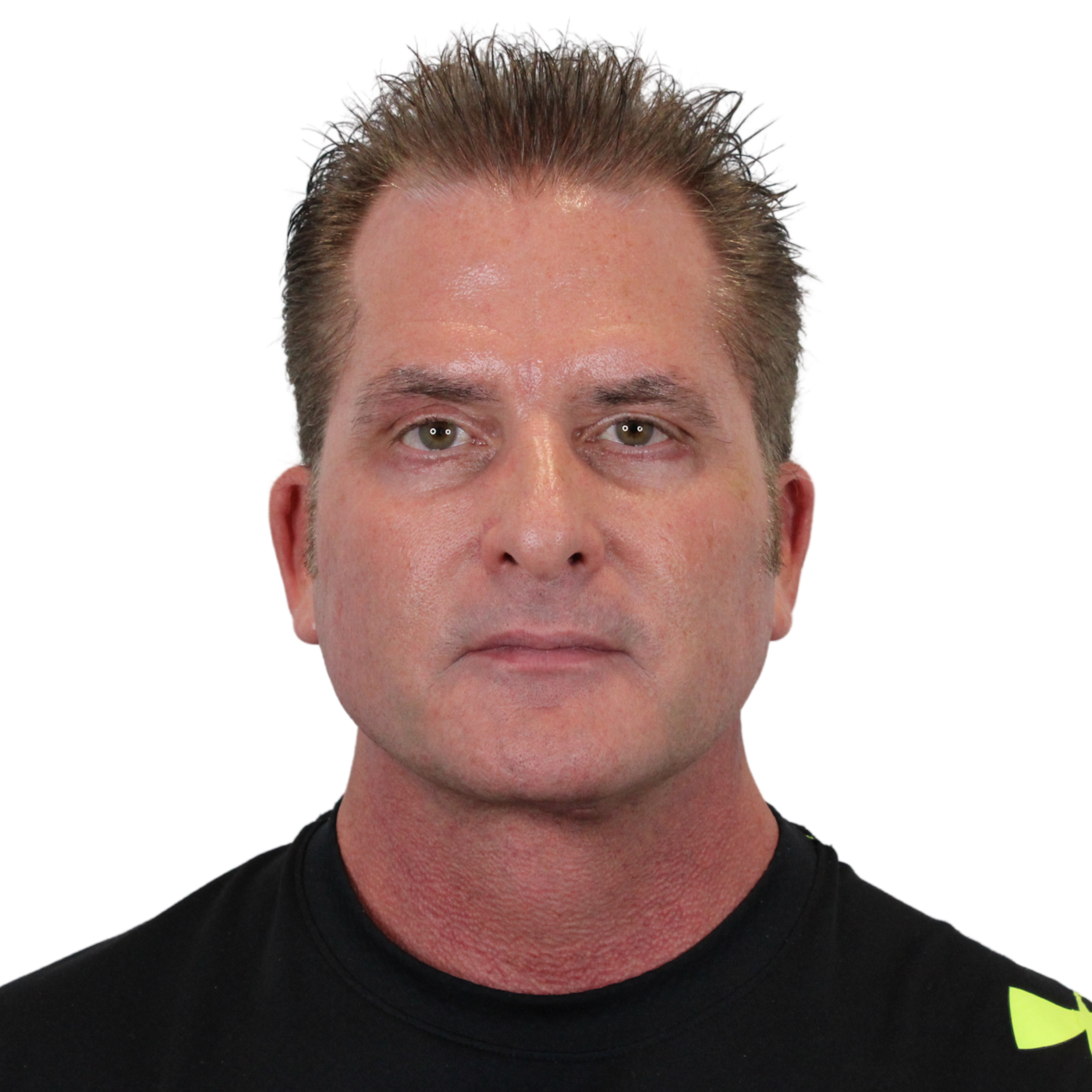 Admire Plastic Surgery facelift after — Gilbert, AZ
