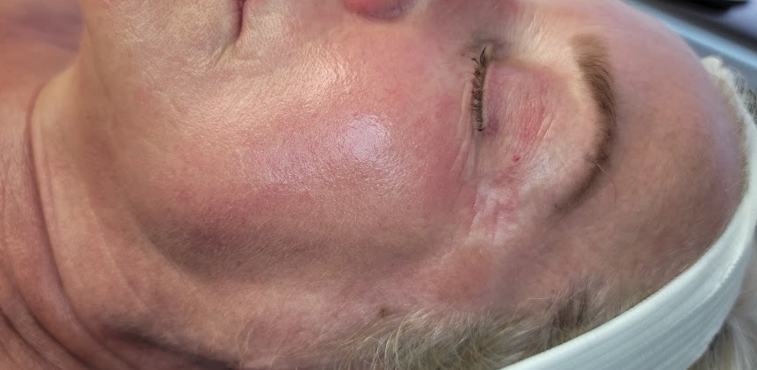 Renewal Aesthetics and Sexual Wellness result — Draper, UT
