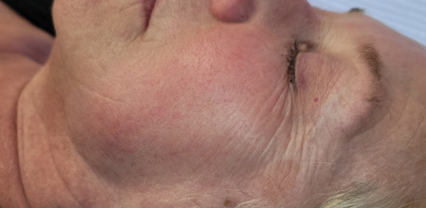 Renewal Aesthetics and Sexual Wellness result — Draper, UT