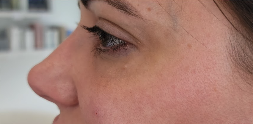 Renewal Aesthetics and Sexual Wellness result — Draper, UT