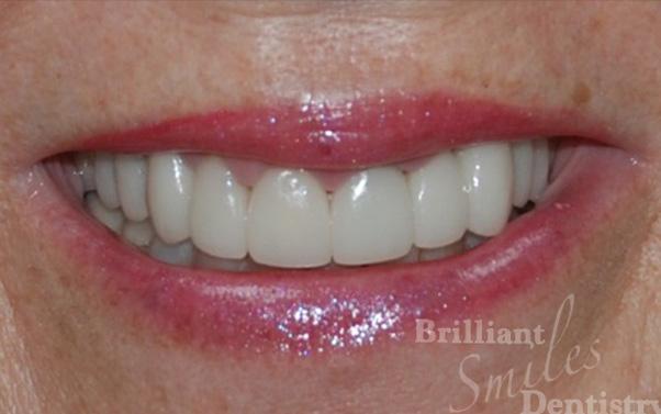 Brilliant Smiles Dentistry provider photo