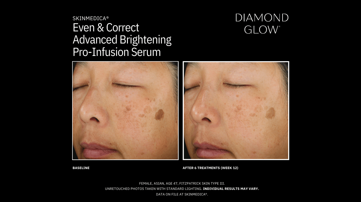 PURE Medical Spa result — Meridian, ID