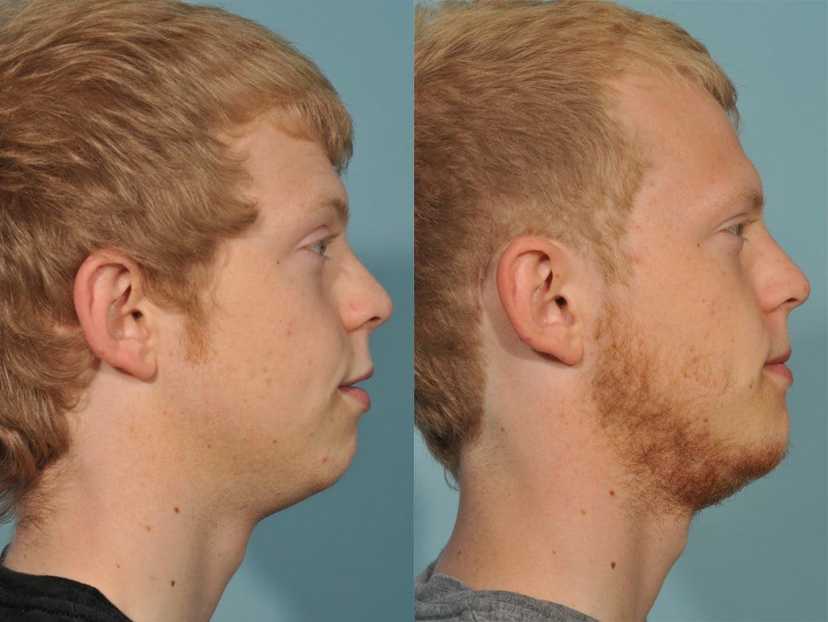 Jesse E Smith, MD, FACS result — Fort Worth, TX