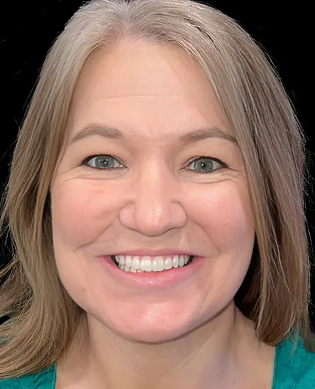 Aria Dental Implant Center dental implants after — Phoenix, AZ