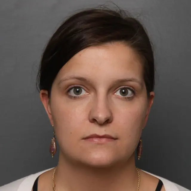 Neck Lift before at Angela Keen | Utah Aesthetic Surgery in Cottonwood Heights, UT