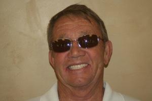 Smile Makeover after at Red Cliffs Dental in St. George, UT