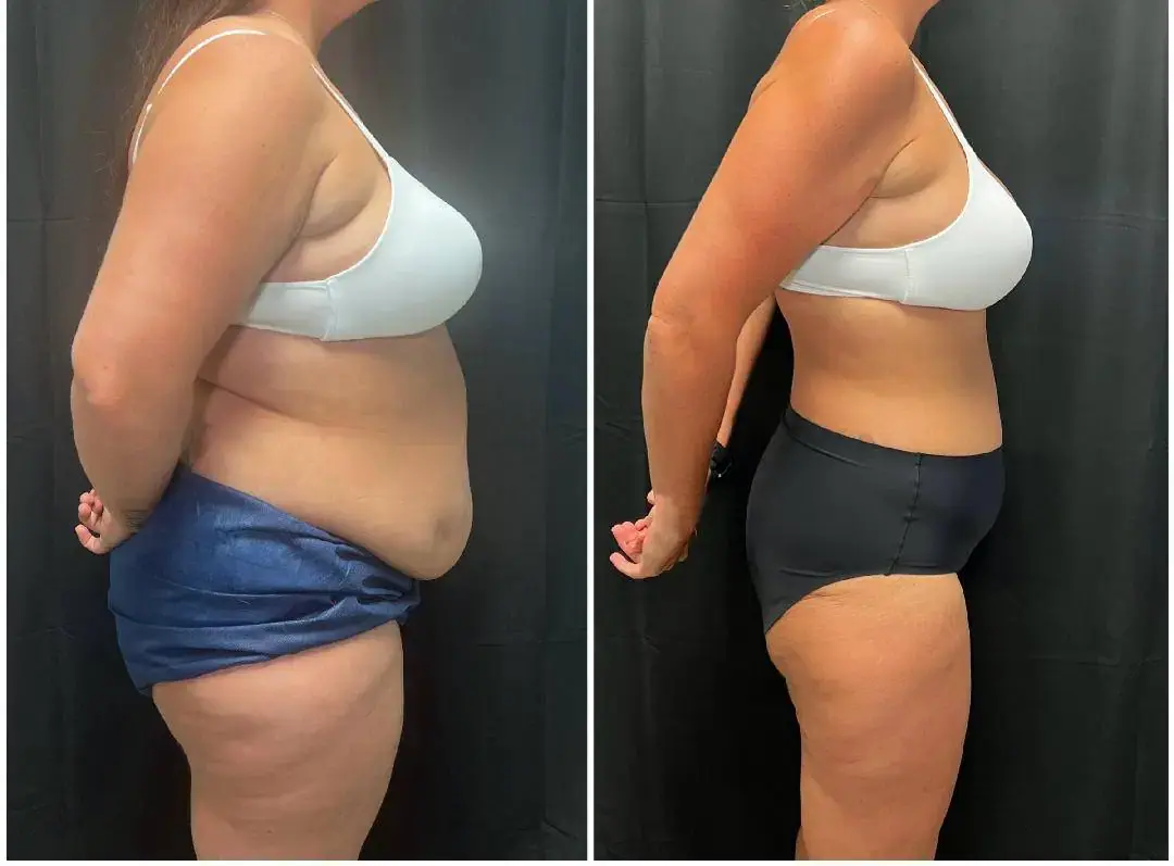 MediMorph result — Crescent Springs, KY