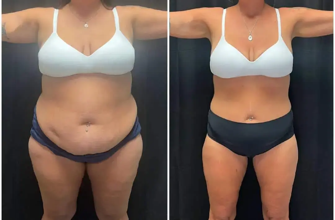 MediMorph result — Crescent Springs, KY