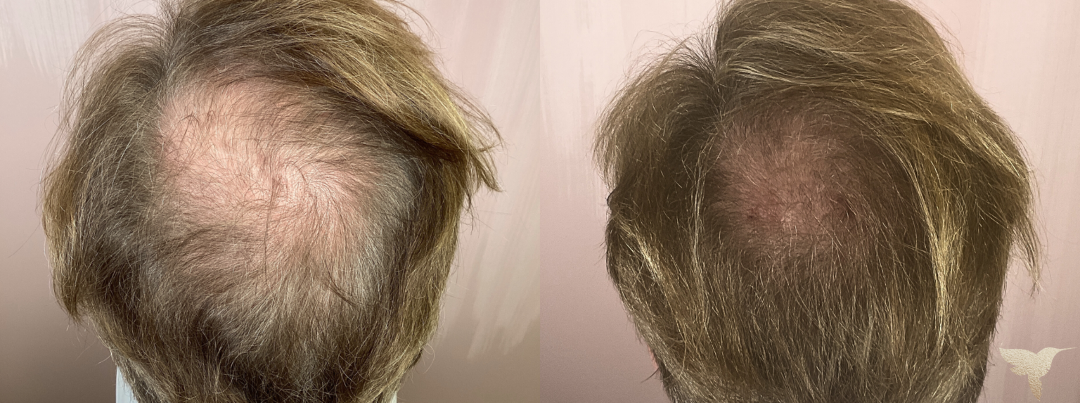 Skin by Lovely result — Santa Monica, CA