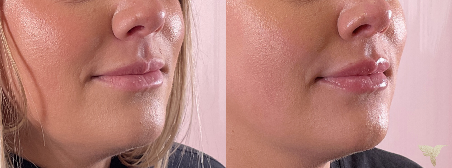 Skin by Lovely result — Santa Monica, CA