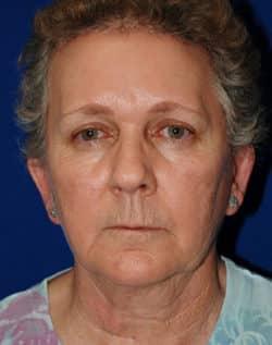 Robert Kessler MD a Medical Corp after — Newport Beach, CA