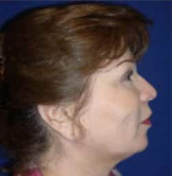 Robert Kessler MD a Medical Corp after — Newport Beach, CA
