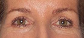 Plastic Surgeon Baltimore, MD: Dr. Alyson Wells after — Cockeysville, MD