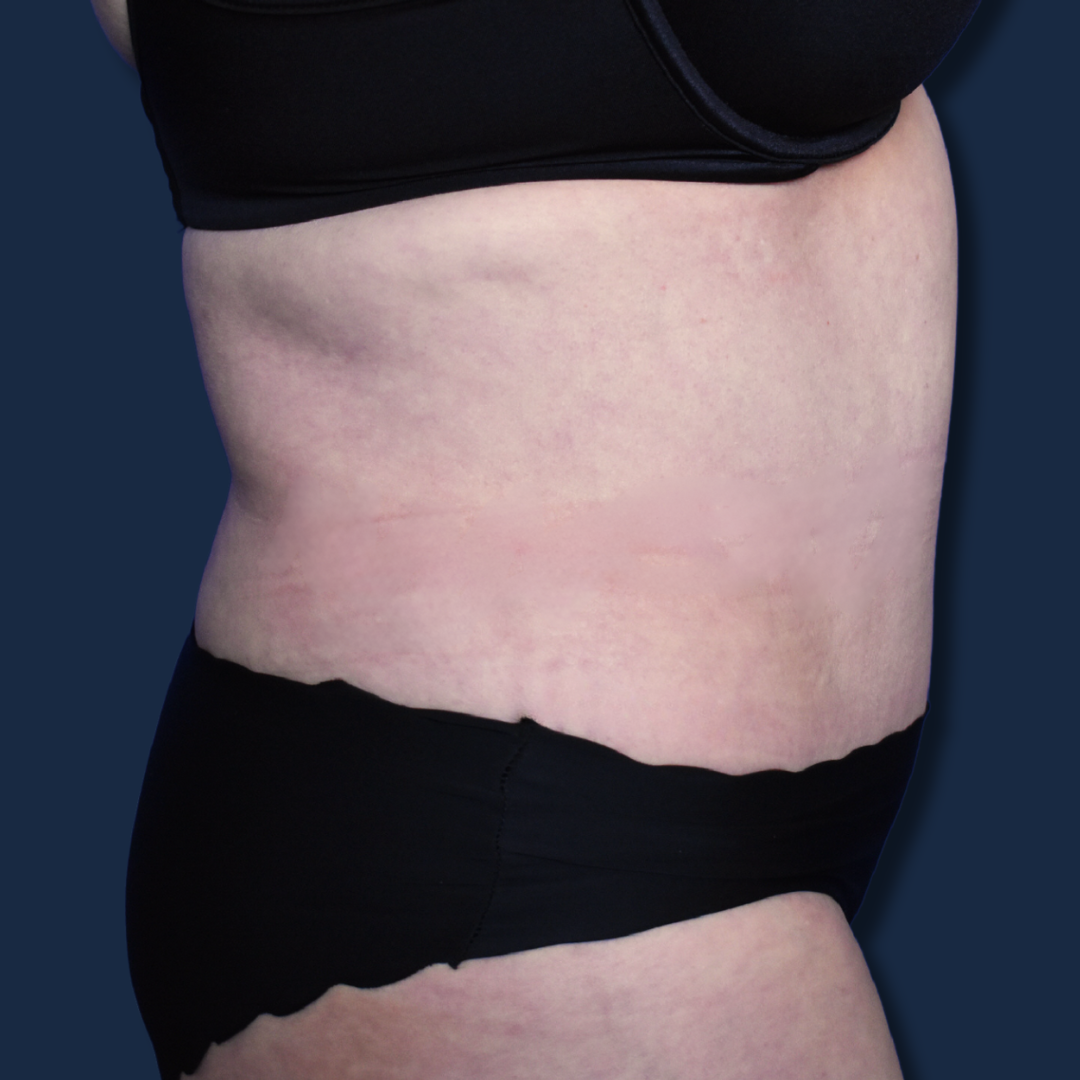 The Surgeonista - Gina Maccarone MD, FACS after — Cincinnati, OH