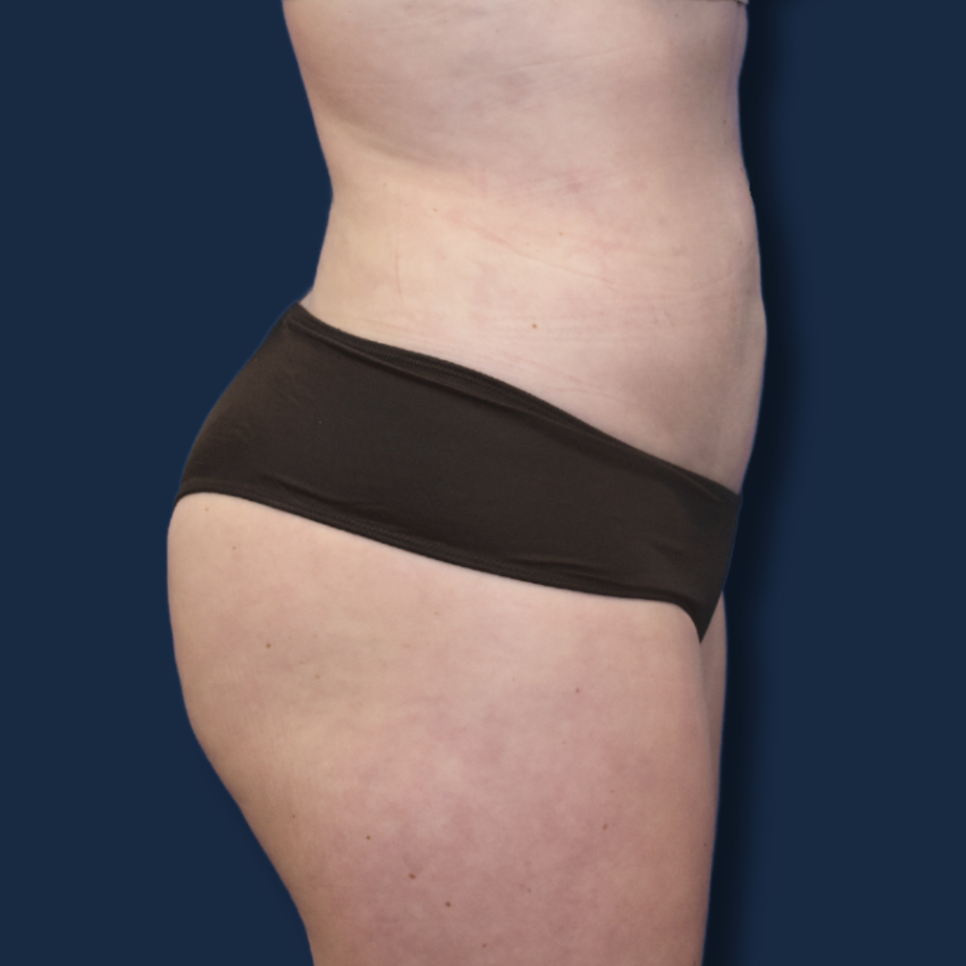 The Surgeonista - Gina Maccarone MD, FACS after — Cincinnati, OH