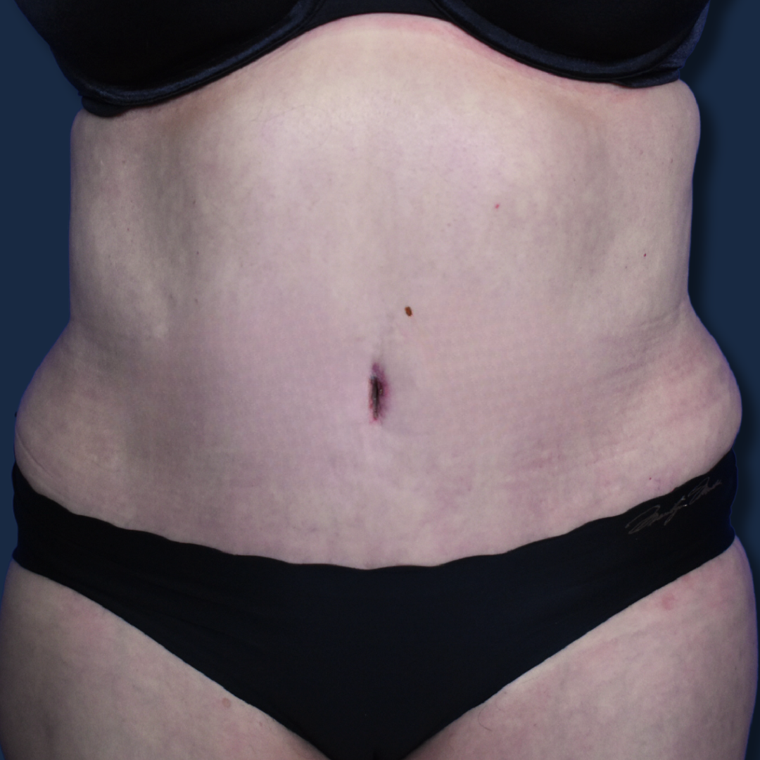 The Surgeonista - Gina Maccarone MD, FACS after — Cincinnati, OH