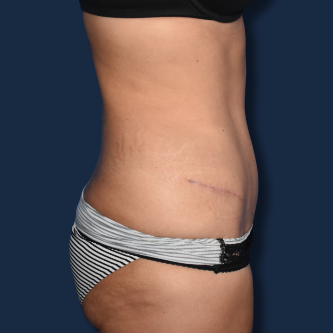 The Surgeonista - Gina Maccarone MD, FACS after — Cincinnati, OH