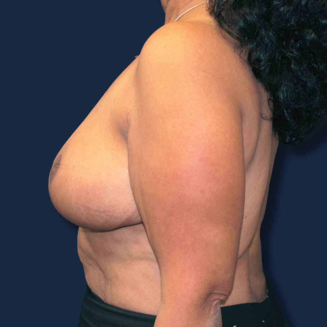 The Surgeonista - Gina Maccarone MD, FACS after — Cincinnati, OH