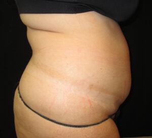Port City Plastic Surgery - Charleston provider photo