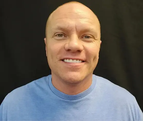 Teeth Whitening after at Salt Lake Smiles in West Jordan, UT