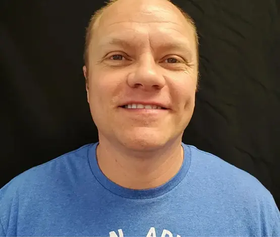 Teeth Whitening before at Salt Lake Smiles in West Jordan, UT