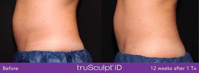 Apex Medical Spa result — Las Vegas, NV