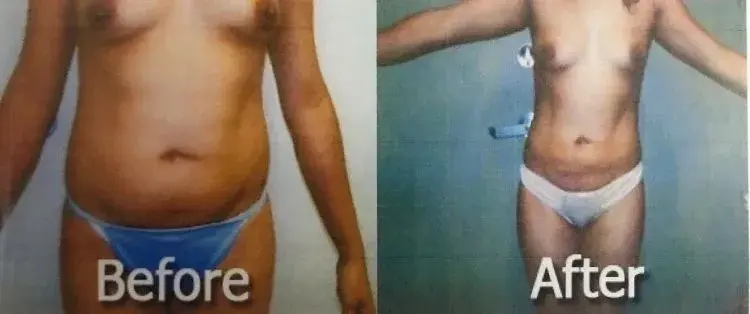 Image Cosmetic Surgery Center result — Acworth, GA