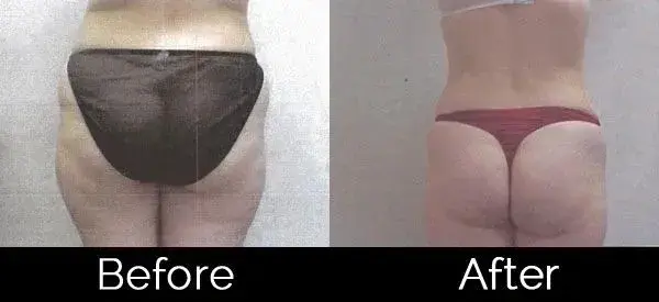 Image Cosmetic Surgery Center result — Acworth, GA