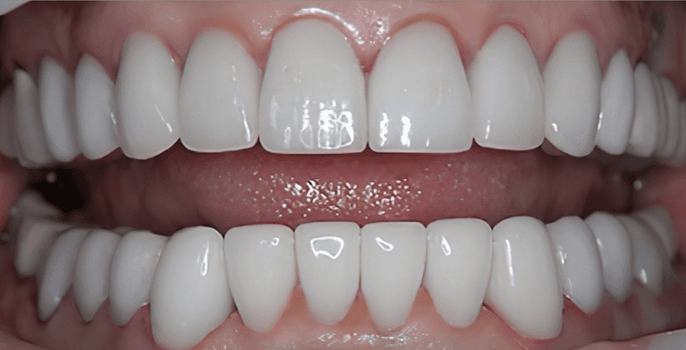 Scottsdale Cosmetic Dentistry smile makeover after — Scottsdale, AZ