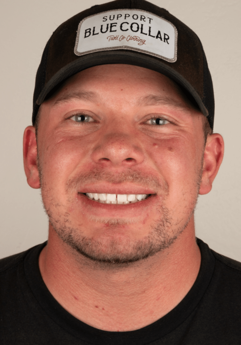 Hoopes Dental veneers after — Ogden, UT
