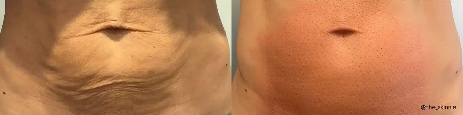 Glow Medical Spa result — Franklin, TN