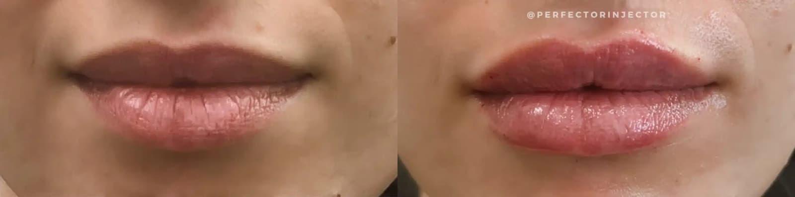 Glow Medical Spa result — Franklin, TN