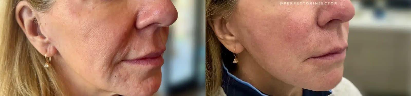 Glow Medical Spa result — Franklin, TN