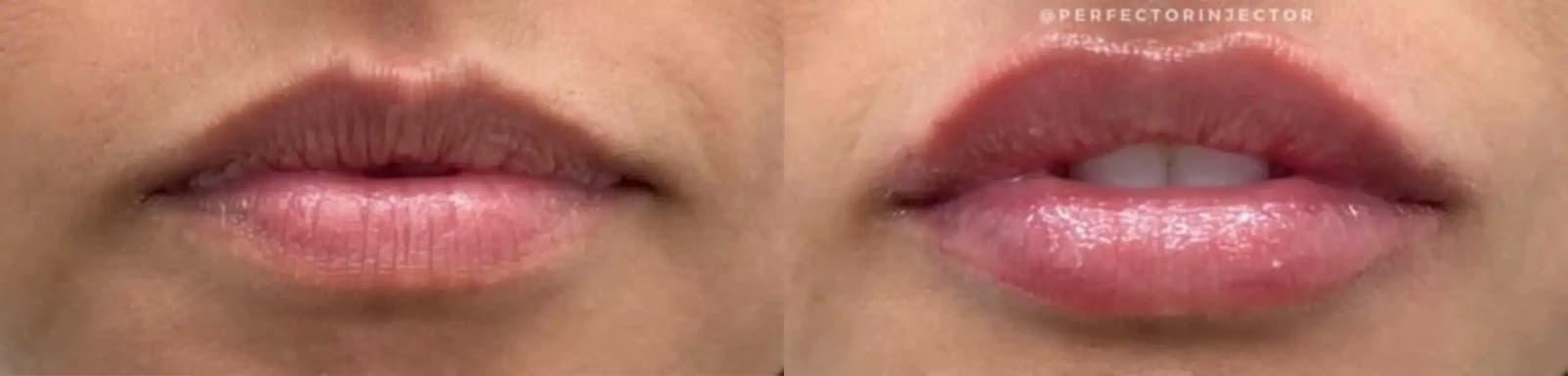 Glow Medical Spa result — Franklin, TN