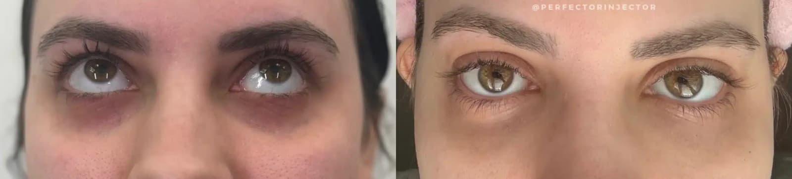 Glow Medical Spa result — Franklin, TN