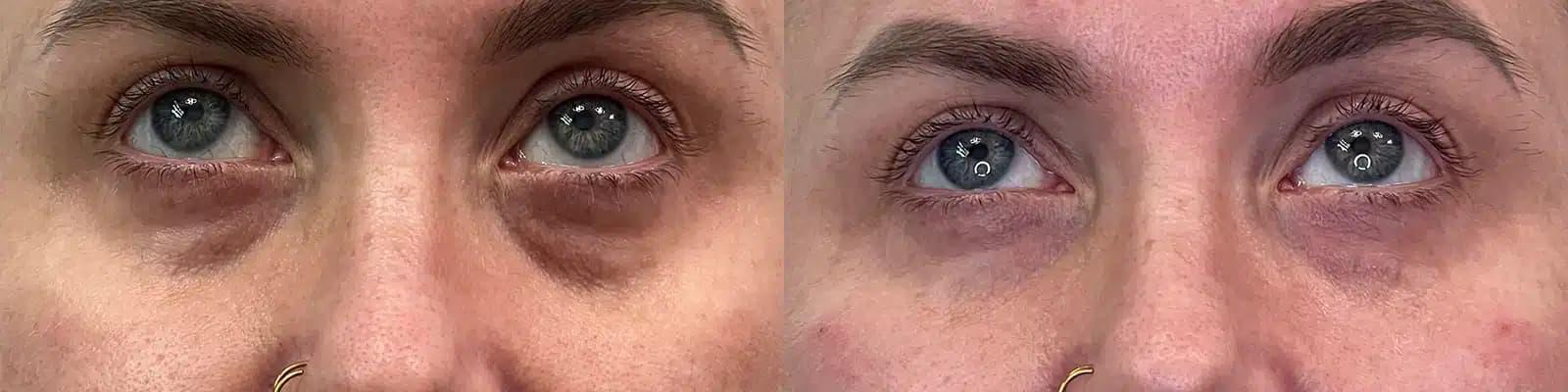 Glow Medical Spa result — Franklin, TN