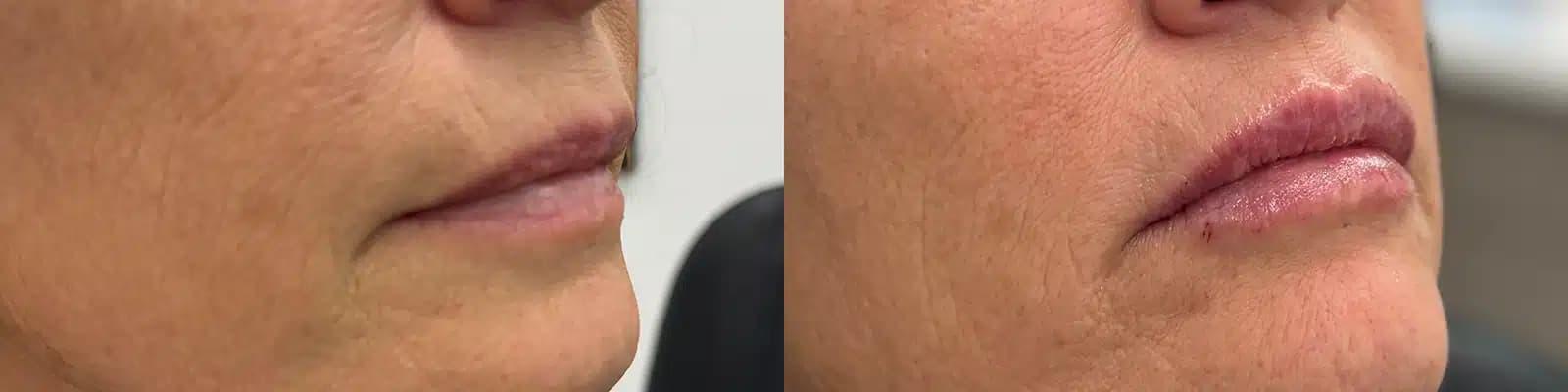 Glow Medical Spa result — Franklin, TN