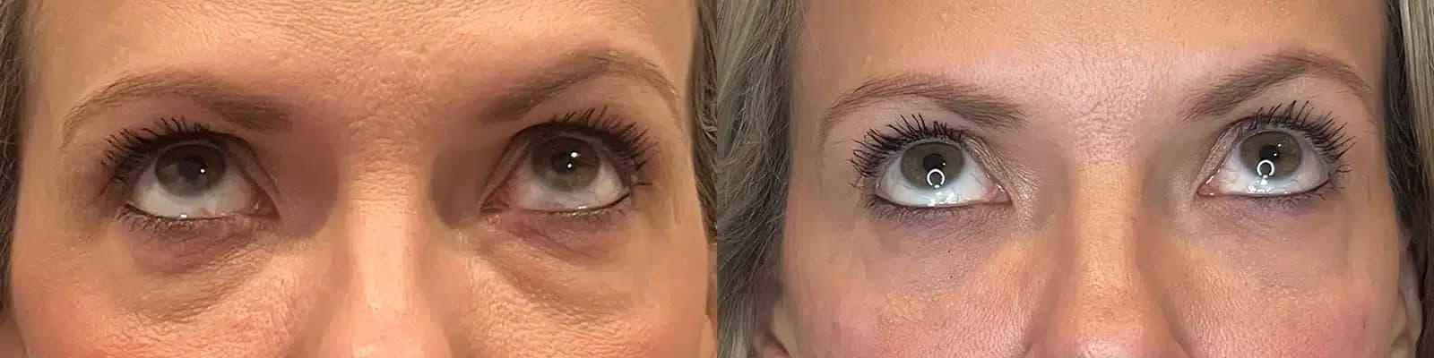 Glow Medical Spa result — Franklin, TN