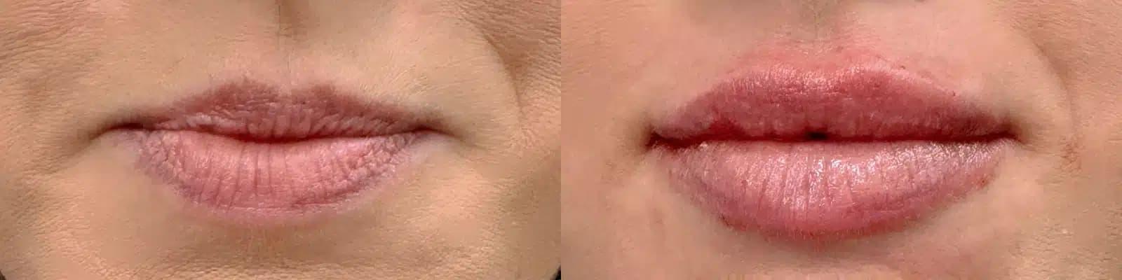 Glow Medical Spa result — Franklin, TN
