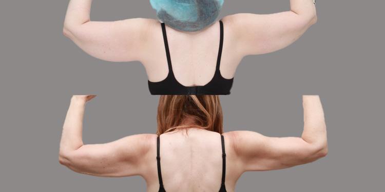 Ditesheim Cosmetic Surgery result — Charlotte, NC