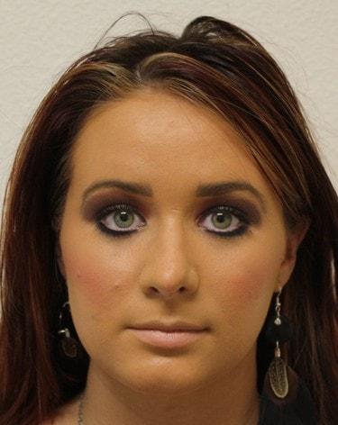 New Tampa Plastic Surgery (G. Peter Fakhre, MD) rhinoplasty after — Wesley Chapel, FL